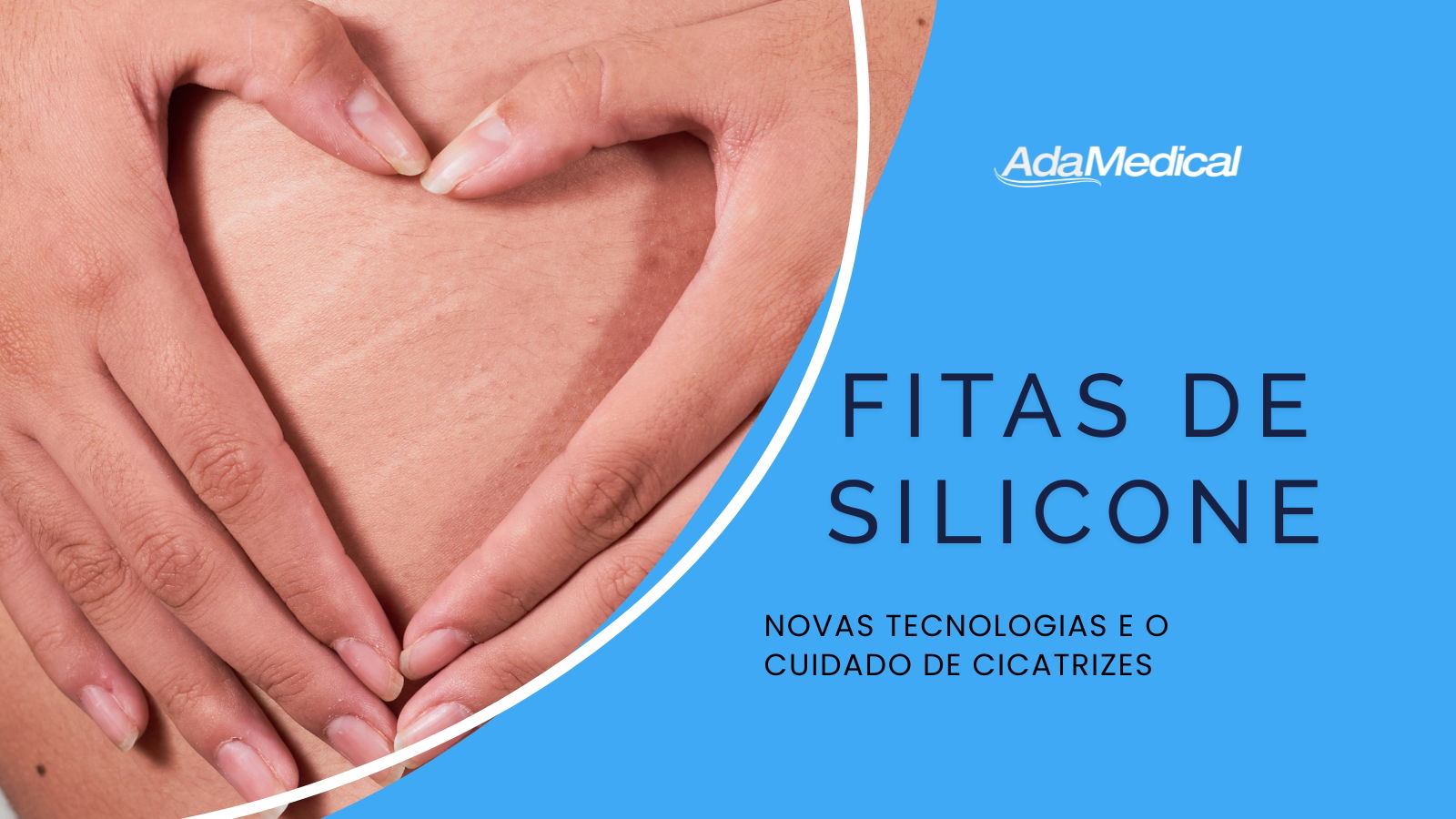 Como a fita de silicone para cicatriz ajuda na cicatrização?